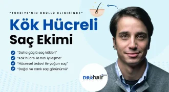 Kök hücreli saç ekimi, hücresel yenilenme ile saç köklerinin daha güçlü tutunmasını sağlar. Saç dökülmesine karşı kalıcı, doğal ve tıbbi olarak desteklenmiş bir çözümdür.