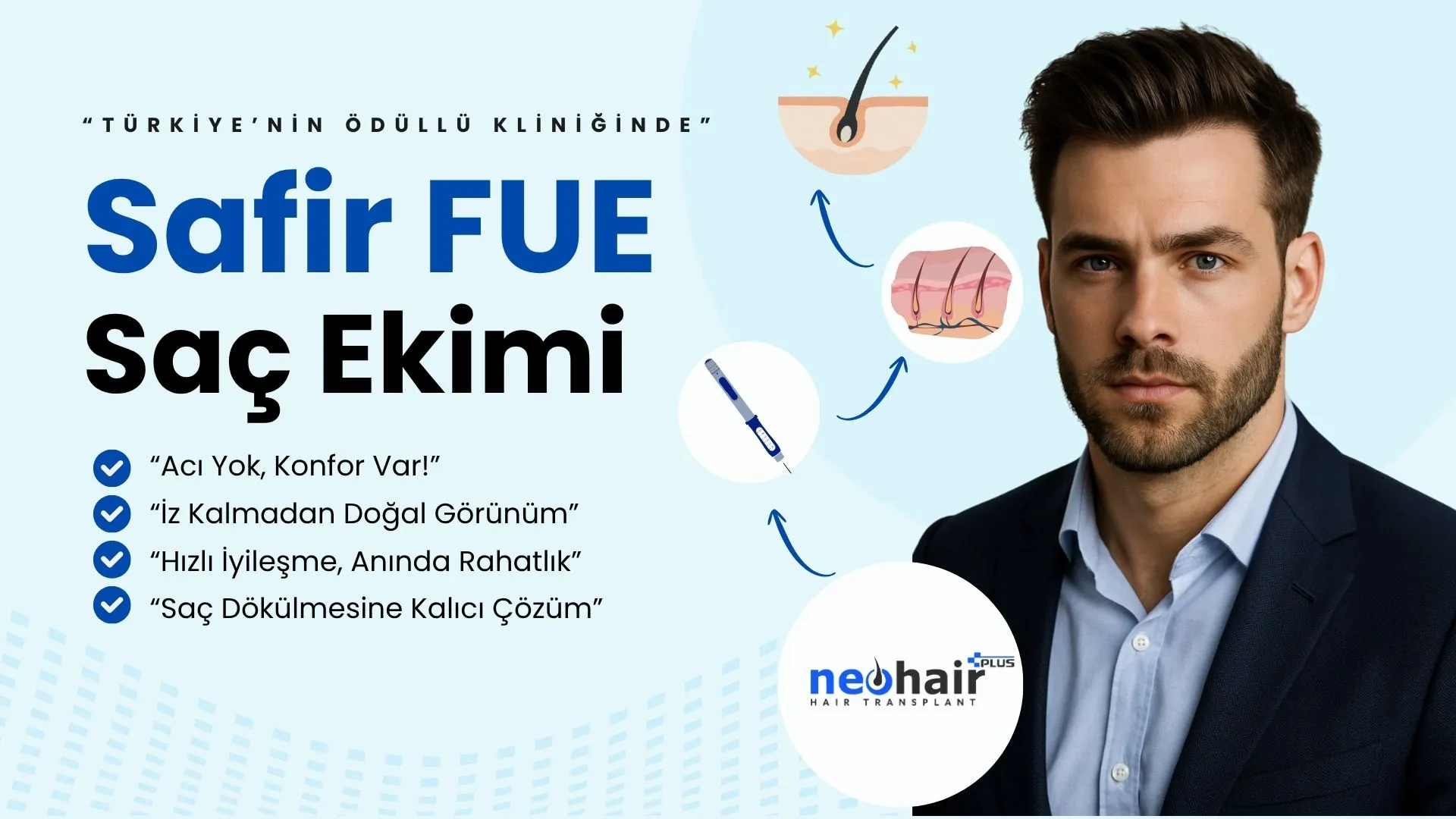 Safir uçlu mikro aletlerle yapılan hassas Safir FUE saç ekimi işlemi, doğal ve yüksek yoğunluklu saç çıkışı sağlar.