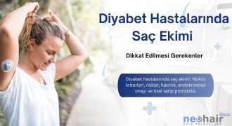 Diyabet hastaları için saç ekimi rehberi ve özel protokol.