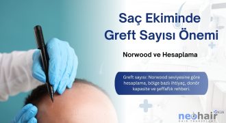 Greft sayısı: Norwood seviyesine göre hesaplama, bölge bazlı ihtiyaç, donör kapasite ve şeffaflık rehberi.