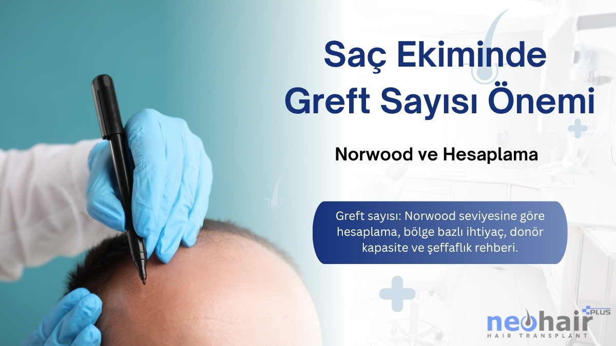 Greft sayısı: Norwood seviyesine göre hesaplama, bölge bazlı ihtiyaç, donör kapasite ve şeffaflık rehberi.